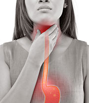 GERD (Gastroesophageal reflux disease)